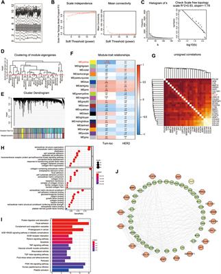 CILP, a Putative Gene Associated With Immune Infiltration in Breast Cancer Brain Metastases